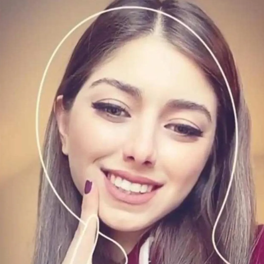 خنده فقط نشانه ی خوشگلی نیست😑