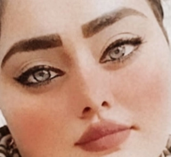 زیبایی