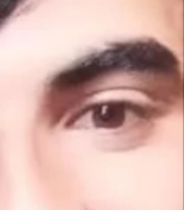 atna