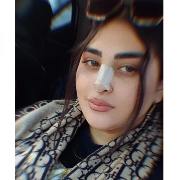 Mobina
