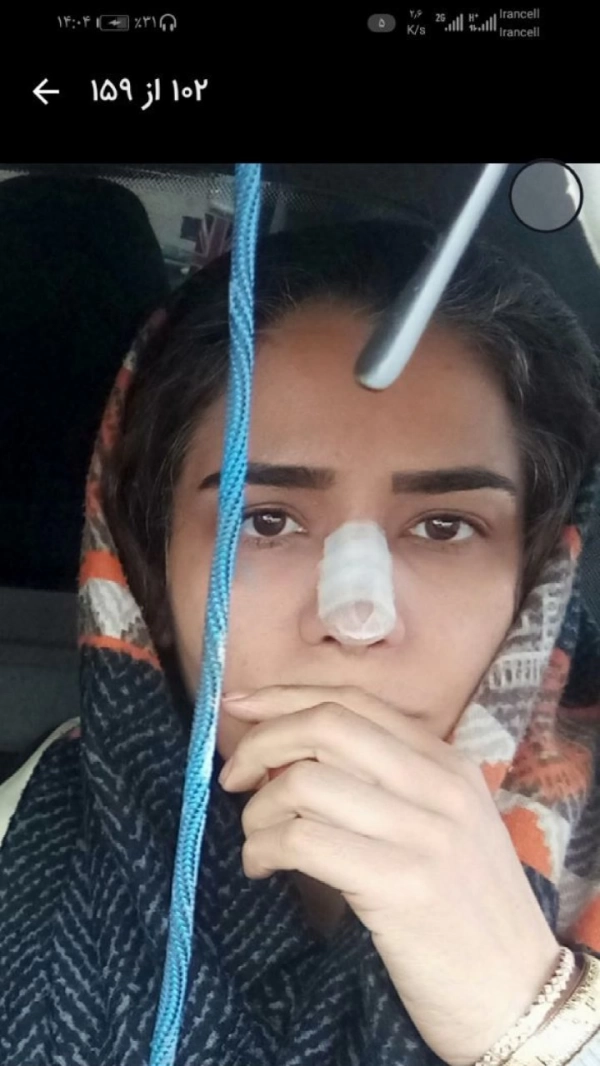 ساده