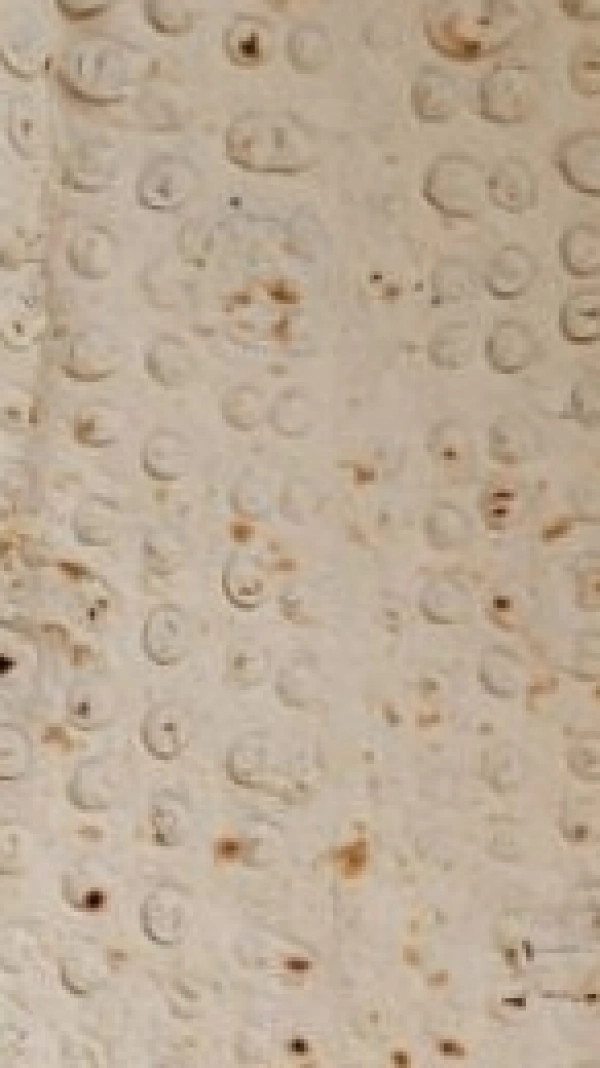سیاره 9125