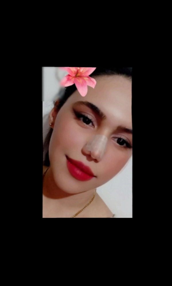 nika