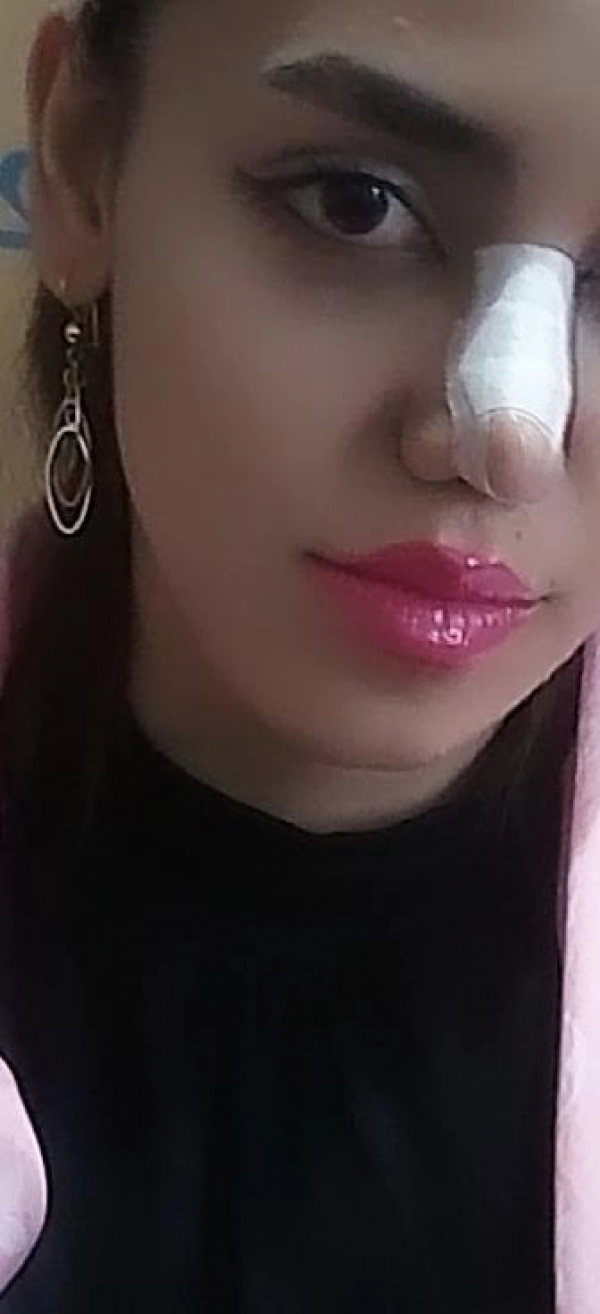 عسل