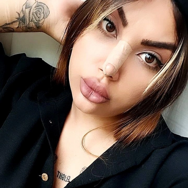 zizii