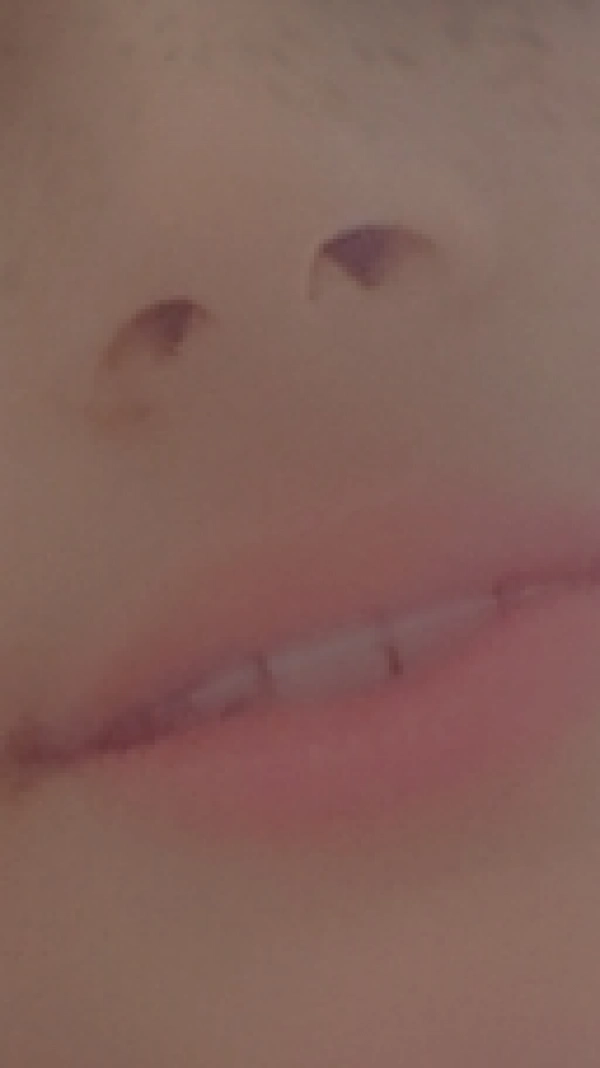 النا