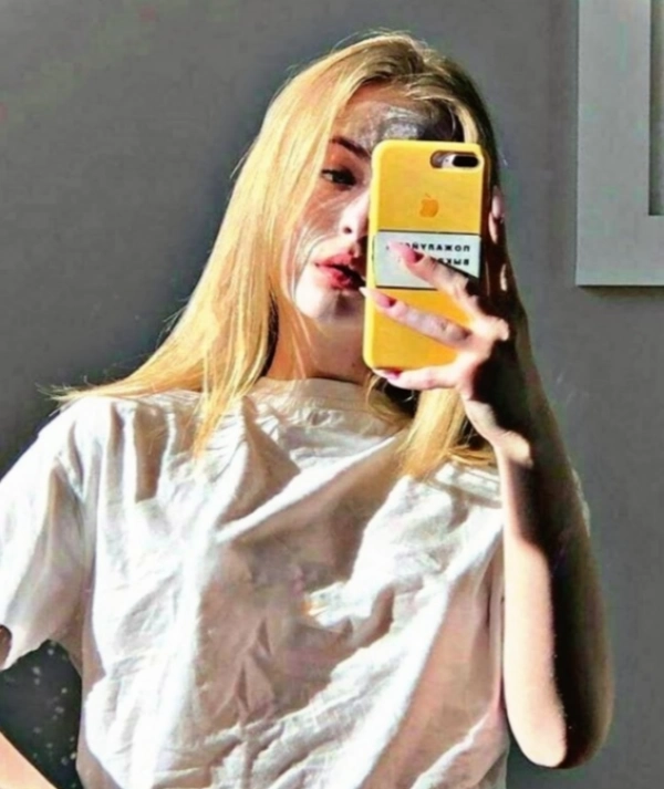 aylin