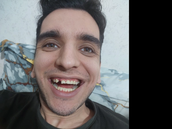erfan